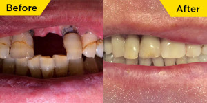 smile-dental-case-dr.Melissa-01