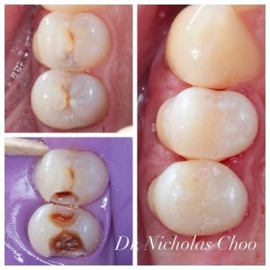 dr.nicholaschoo-photo-DBPAtBdPvE7-20241202_224220_463640148