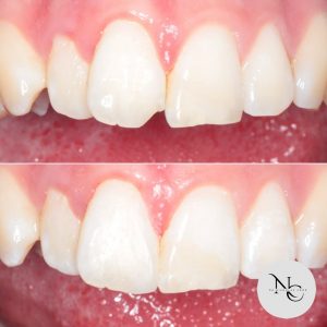 dr.nicholaschoo-photo-DJ38SpipkEc-20250801_052459_499525393