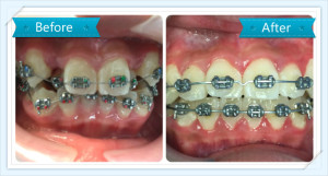 Dr. Abdulla_dentist_case_3