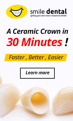 fast crowns