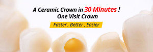 one_visit_crown