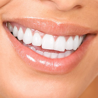 whitening whitening